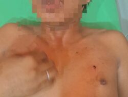 Polisi Buru Pelaku Penikaman di Plampang, Korban Ditikam Tanpa Sebab yang Jelas