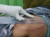 Cekcok Mulut Berujung Kekerasan, Oknum PNS di Lape Aniaya Dua IRT dengan Parang