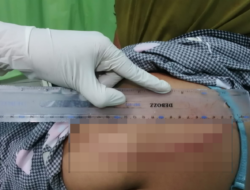 Cekcok Mulut Berujung Kekerasan, Oknum PNS di Lape Aniaya Dua IRT dengan Parang